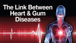 Link between heart and gum diseases